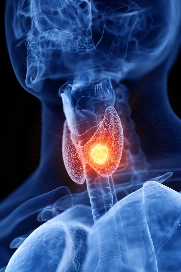 A 3D illustration of an x-ray of a human neck, highlighting the thyroid. Get help with thyroid imbalance from The Cove Concierge Medicine in Denver.